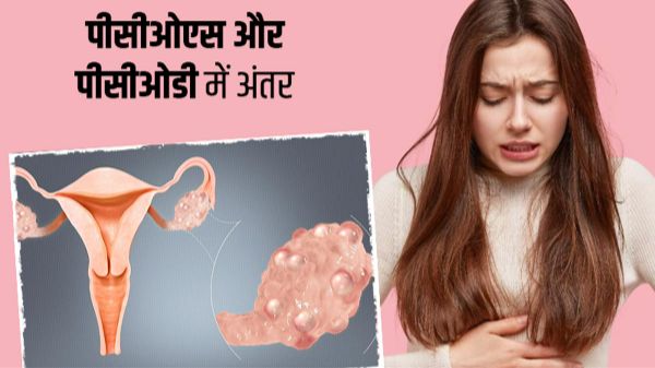 pcod pcos in hindi
